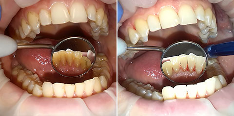 Dental Hygiene Prag Tschechien Brandeis Clinic